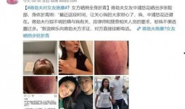 默默吃瓜后续2,揭秘娱乐圈背后的真相与风波