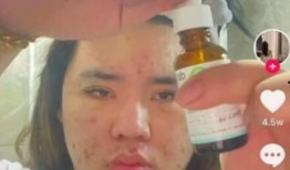 卖吃瓜视频赚钱,揭秘吃瓜视频如何变现吸金